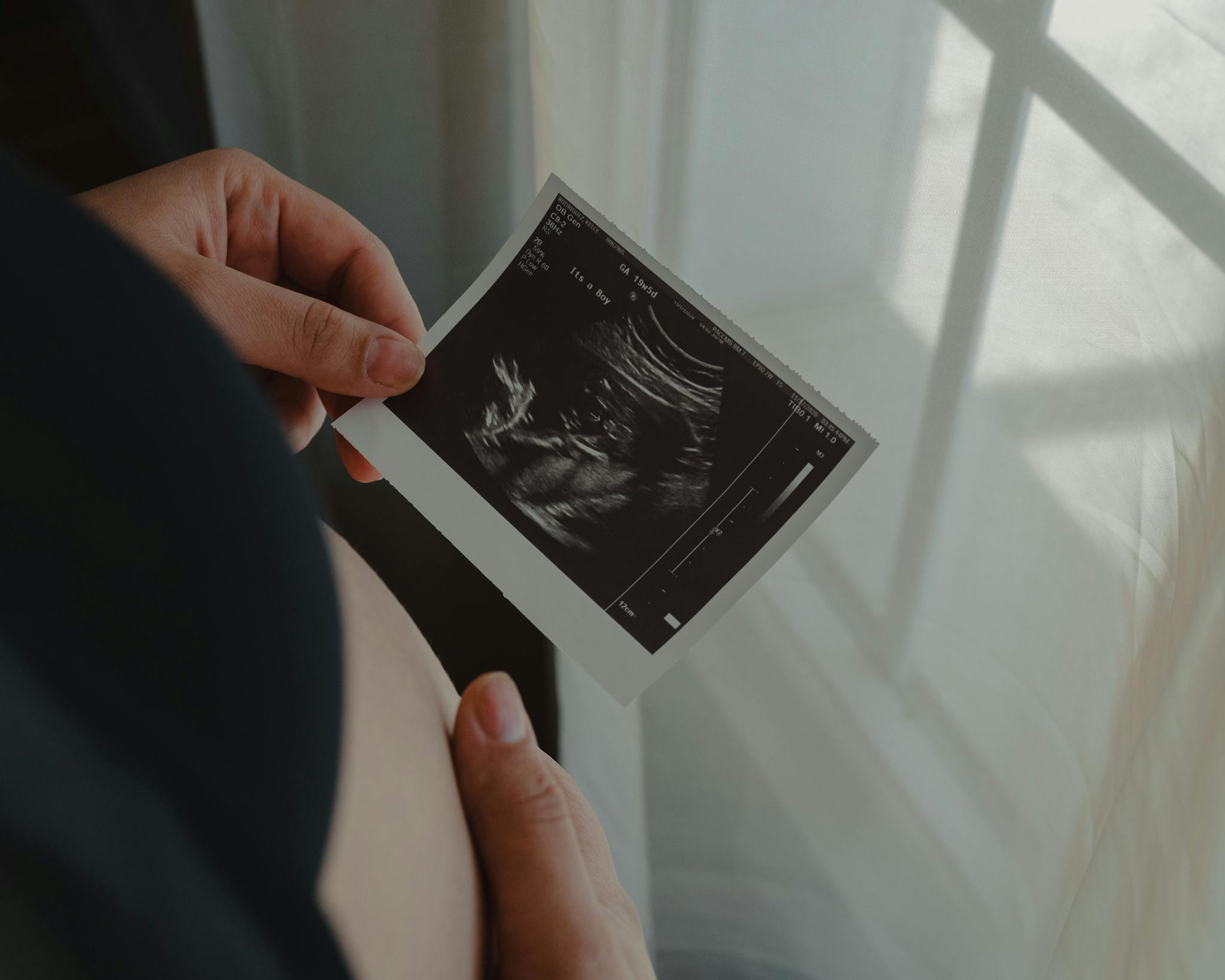 Pregnant woman holding an ultrasound scan of her unborn child, symbolizing motherhood.