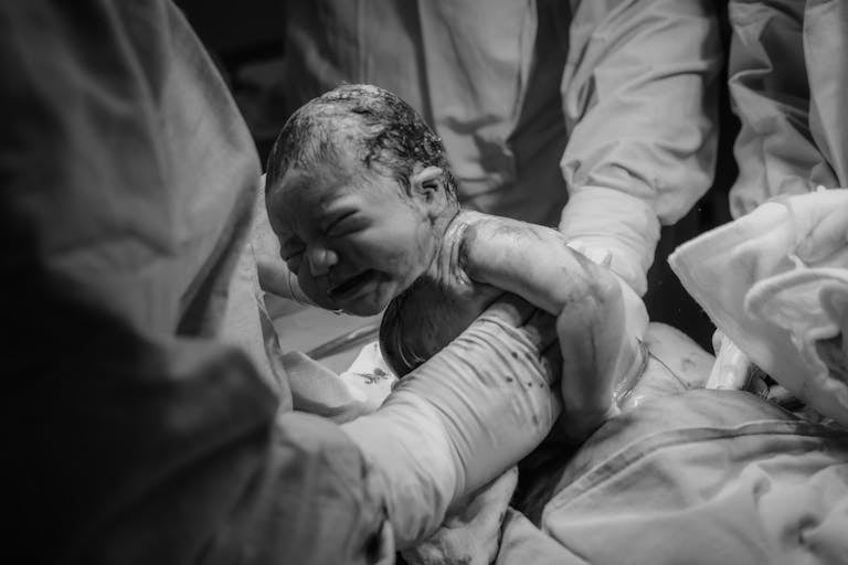 Black and white photograph capturing a newborn baby being delivered in a hospital by medical staff. Everything You Need to Know About Labour: From Signs to Stages and Pain Relief Options